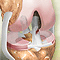 ACL injury
