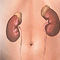 Dialysis