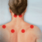 Fibromyalgia