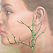 Hodgkin lymphoma
